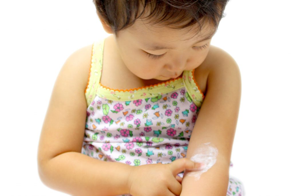 小児のアトピー性皮膚炎
